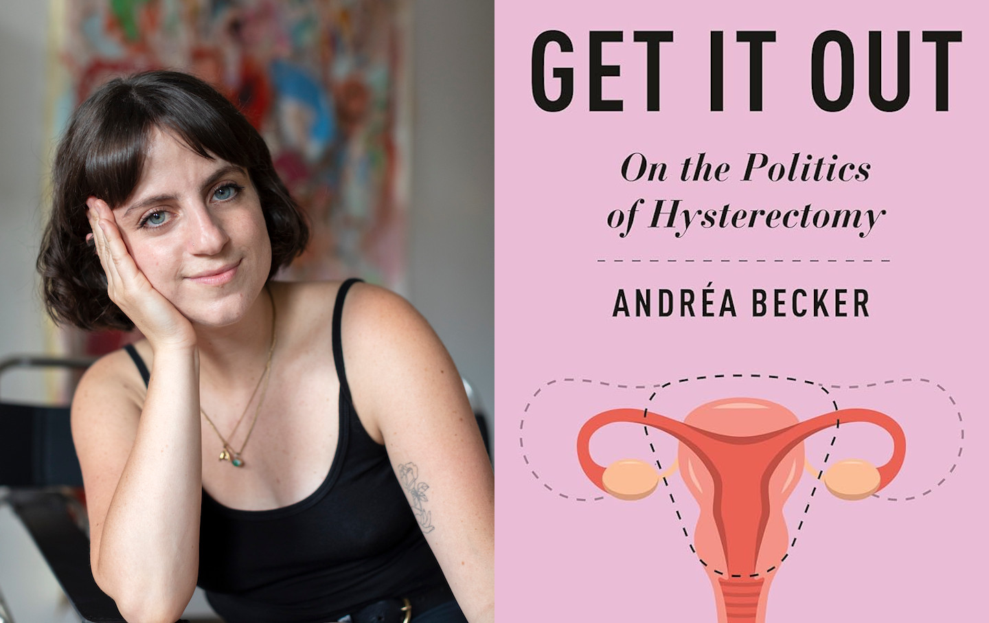 Andréa Becker on the Politics of Hysterectomy